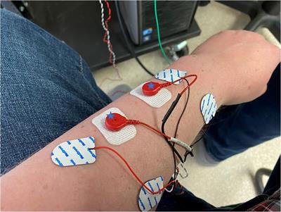 Intermuscular Coherence in the Presence of Electrical Stimulation